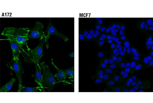 Immunofluorescence Image 1: N-Cadherin (D4R1H) XP® Rabbit mAb