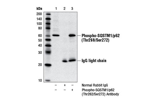 Immunoprecipitation Image 1: Phospho-SQSTM1/p62 (Thr269/Ser272) Antibody