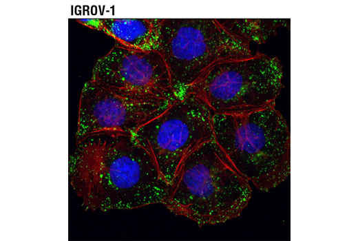 Immunofluorescence Image 1: LAMTOR4/C7orf59 (D4P6O) Rabbit mAb