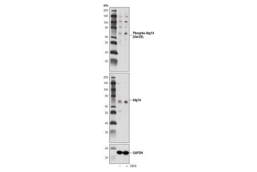 Western Blotting Image 3: Phospho-Atg14 (Ser29) Antibody