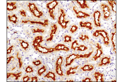 Immunohistochemistry Image 1: NT5E/CD73 (D7F9A) Rabbit mAb