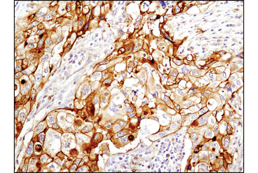 Immunohistochemistry Image 3: NT5E/CD73 (D7F9A) Rabbit mAb