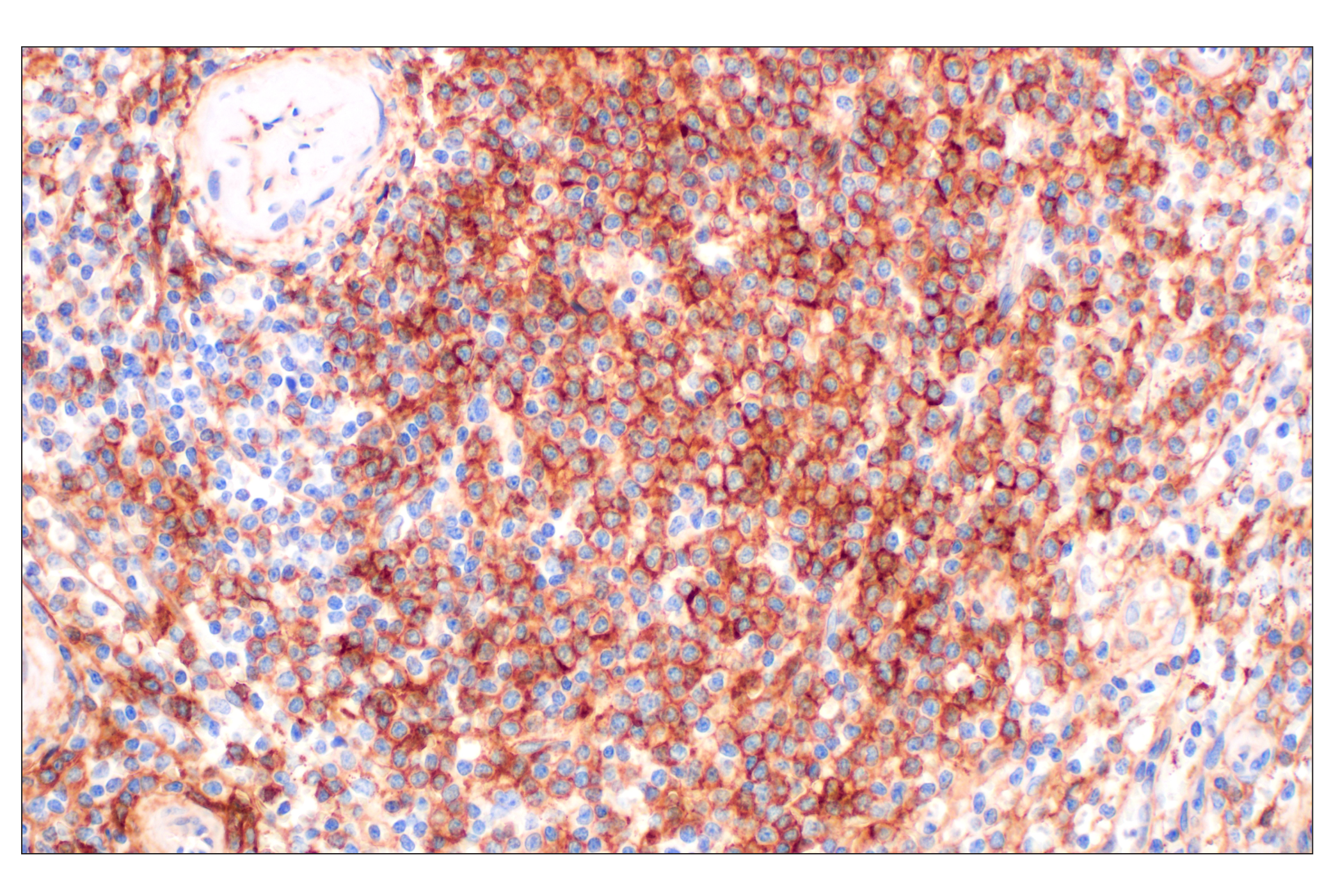Immunohistochemistry Image 4: NT5E/CD73 (D7F9A) Rabbit mAb