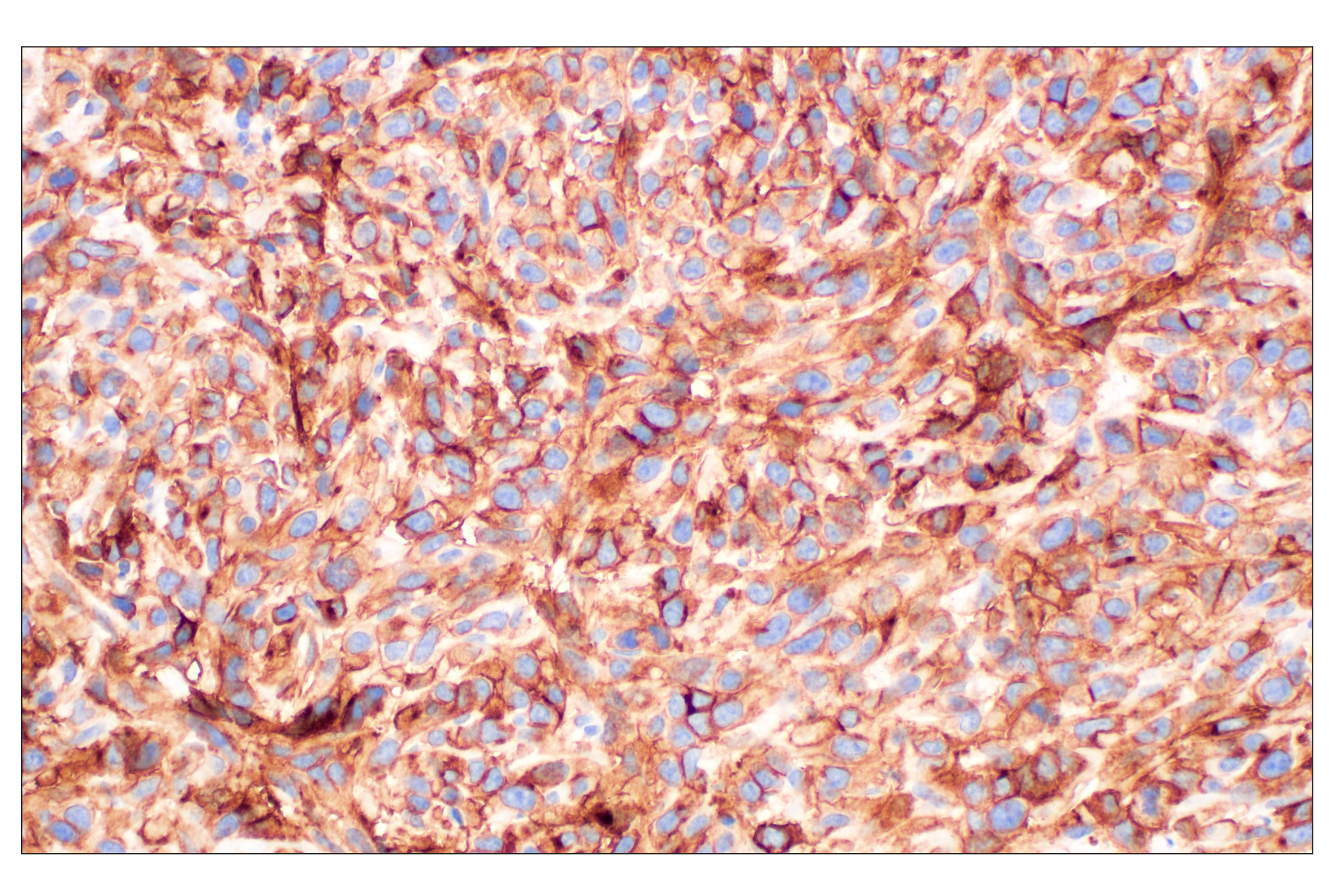 Immunohistochemistry Image 5: NT5E/CD73 (D7F9A) Rabbit mAb
