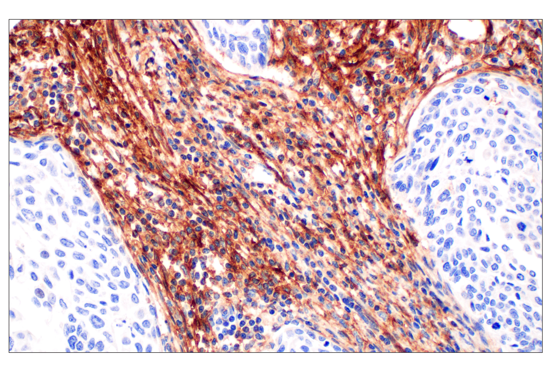 Immunohistochemistry Image 2: NT5E/CD73 (D7F9A) Rabbit mAb