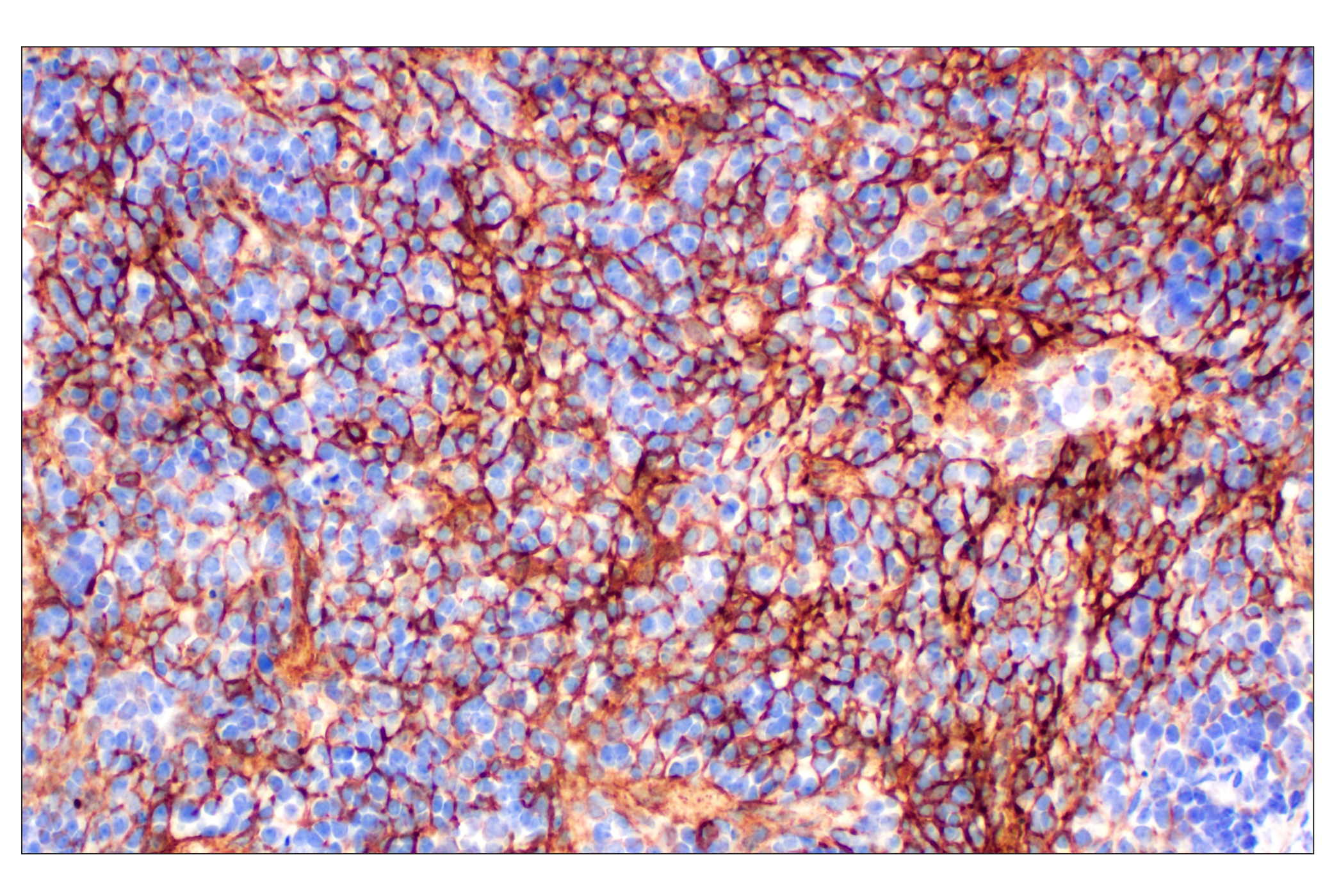 Immunohistochemistry Image 7: NT5E/CD73 (D7F9A) Rabbit mAb