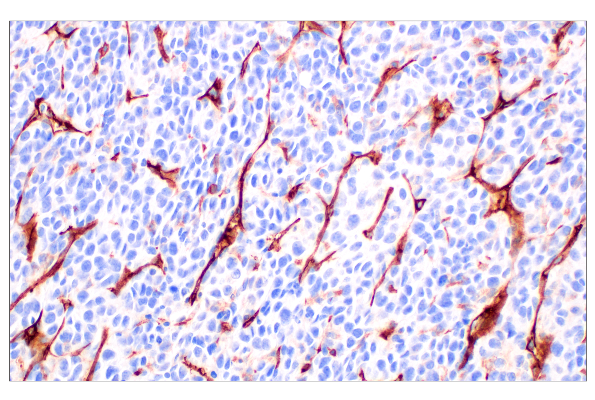 Immunohistochemistry Image 6: NT5E/CD73 (D7F9A) Rabbit mAb