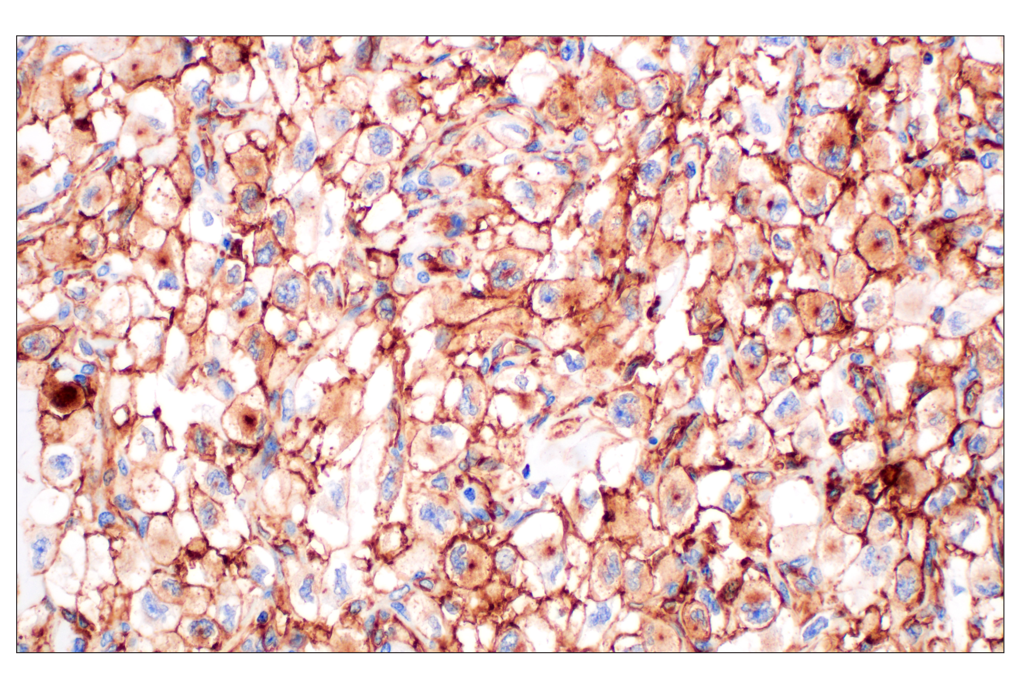 Immunohistochemistry Image 3: NT5E/CD73 (D7F9A) Rabbit mAb