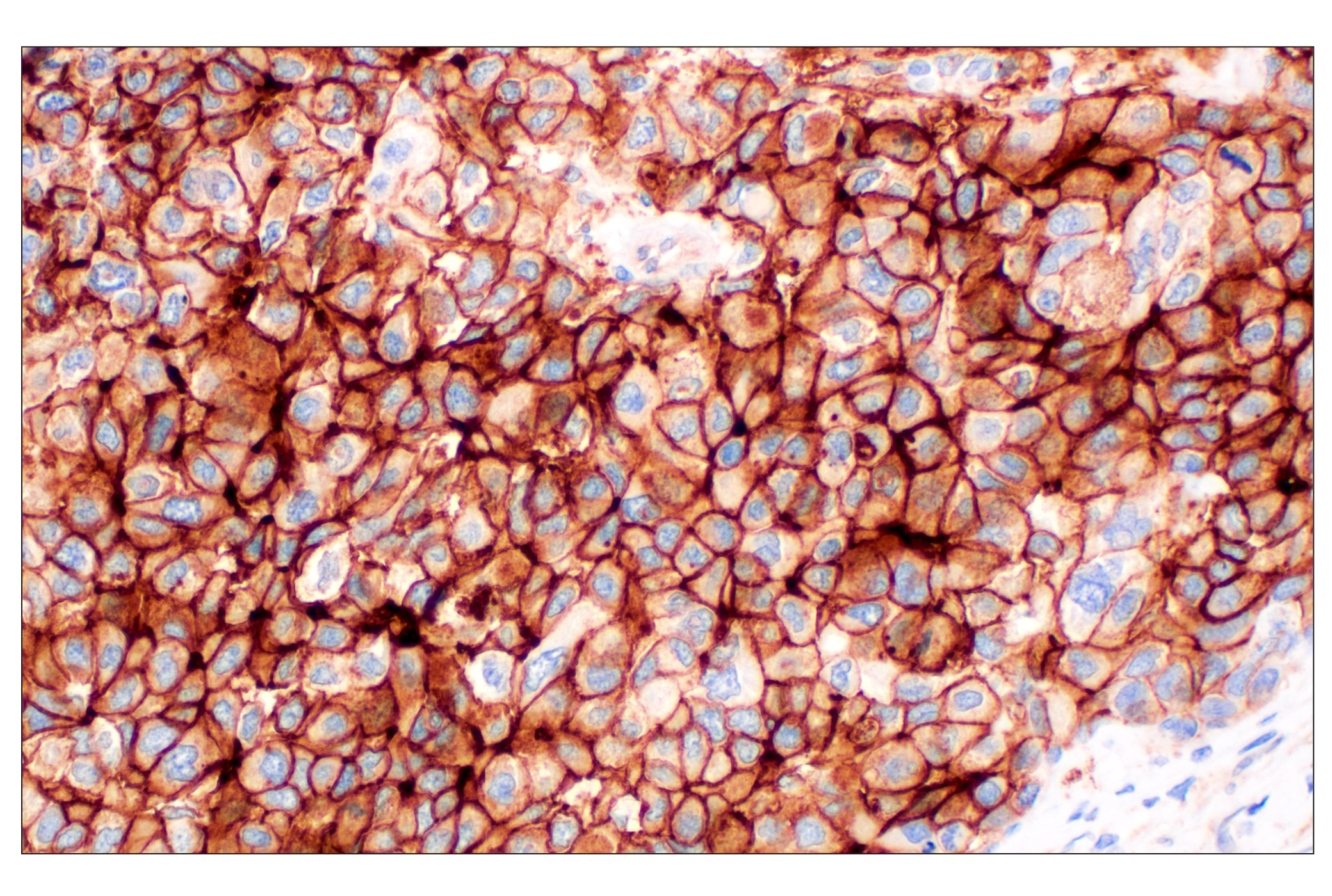 Immunohistochemistry Image 1: NT5E/CD73 (D7F9A) Rabbit mAb