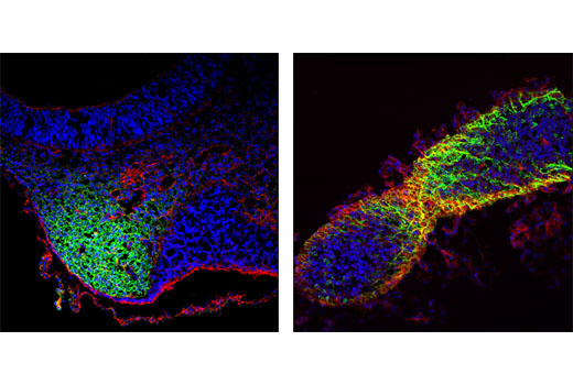 Immunofluorescence Image 1: CRABP1 (D7F9T) Rabbit mAb