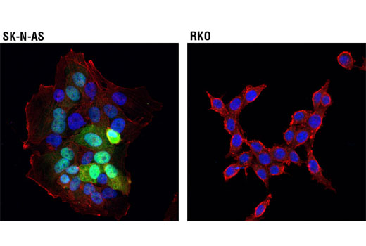 Immunofluorescence Image 2: CRABP1 (D7F9T) Rabbit mAb