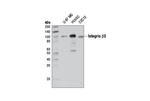 Western Blotting Image 1: Integrin β3 (D7X3P) XP® Rabbit mAb