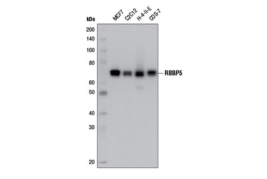  Image 1: Lysine Methyltransferase Antibody Sampler Kit