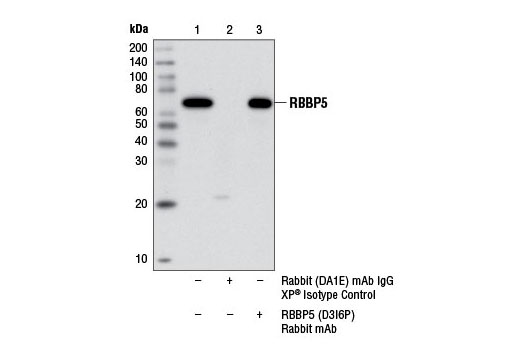 Immunoprecipitation Image 1: RBBP5 (D3I6P) Rabbit mAb