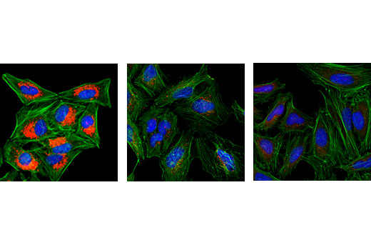 Immunofluorescence Image 1: LC3A/B (D3U4C) XP® Rabbit mAb (Alexa Fluor® 555 Conjugate)