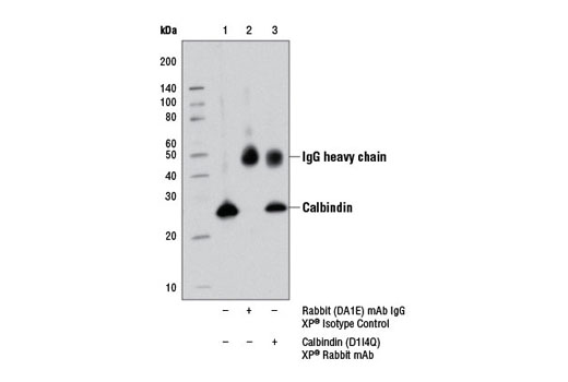 Immunoprecipitation Image 1: Calbindin (D1I4Q) XP® Rabbit mAb