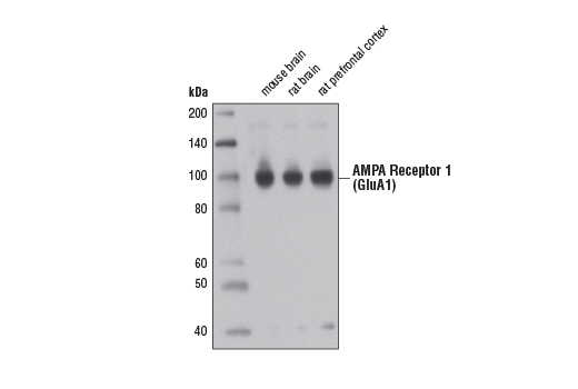 Western Blotting Image 1: AMPA Receptor 1 (GluA1) (D4N9V) Rabbit mAb
