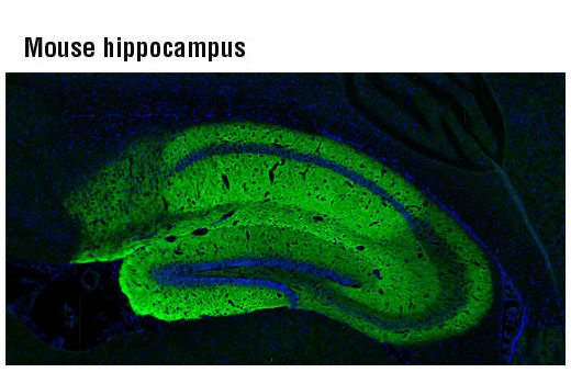 Immunofluorescence Image 1: AMPA Receptor 1 (GluA1) (D4N9V) Rabbit mAb