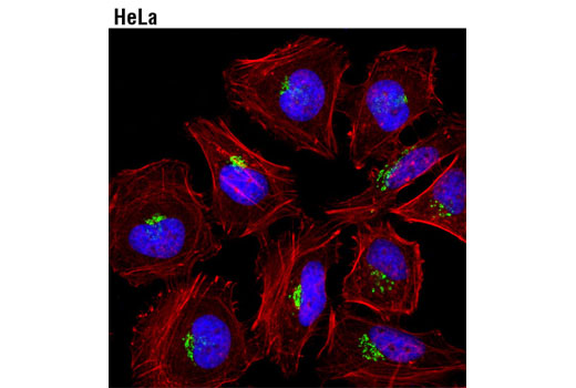 Immunofluorescence Image 1: Golgin-97 (D8P2K) Rabbit mAb