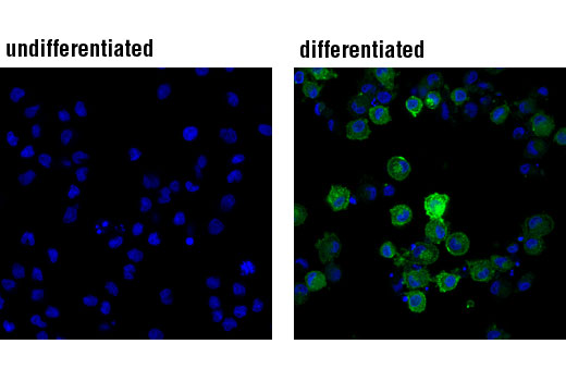 Immunofluorescence Image 1: DC-SIGN (D7F5C) XP® Rabbit mAb