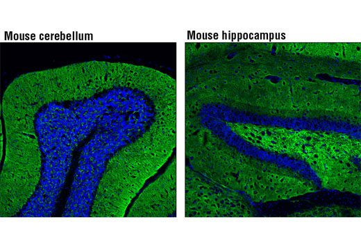 Immunofluorescence Image 1: Synapsin-1 (D12G5) XP® Rabbit mAb (Alexa Fluor® 488 Conjugate)