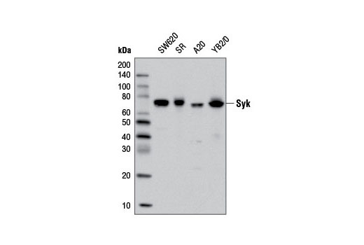  Image 1: PhosphoPlus® Syk (Tyr525/526) Antibody Duet
