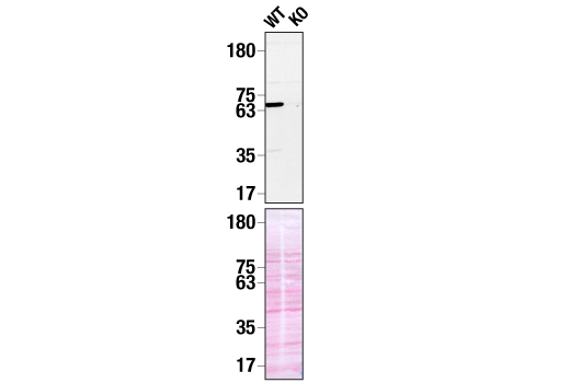  Image 13: B Cell Signaling Antibody Sampler Kit II