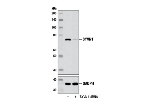  Image 1: SignalSilence® SYVN1 siRNA I