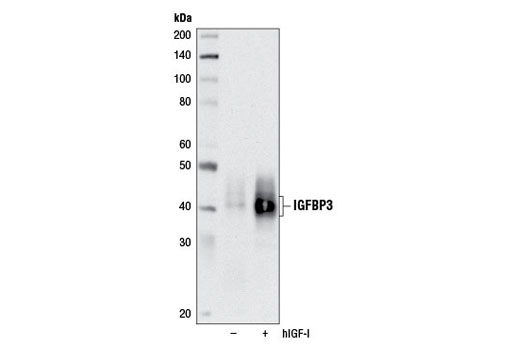 Western Blotting Image 1: IGFBP3 Antibody