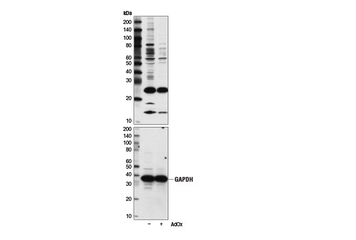 Western Blotting Image 1: Symmetric Di-Methyl Arginine Motif [sdme-RG] MultiMab®  Rabbit mAb mix