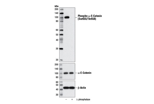 Western Blotting Image 1: Phospho-α-E-Catenin (Ser655/Thr658) Antibody