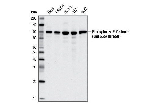 Western Blotting Image 3: Phospho-α-E-Catenin (Ser655/Thr658) Antibody