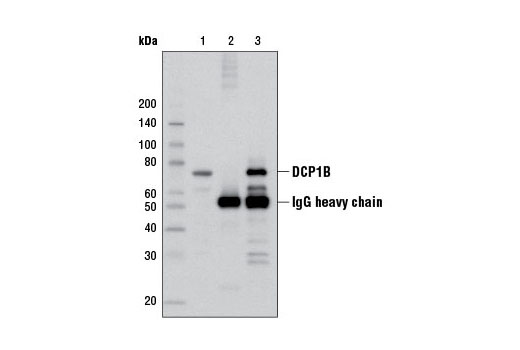 Immunoprecipitation Image 1: DCP1B (D2P9W) Rabbit mAb