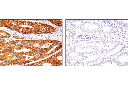 Immunohistochemistry Image 2: CD46 (D6N7H) Rabbit mAb