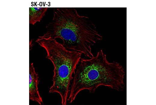 Immunofluorescence Image 1: Kinectin 1 (D5F7J) Rabbit mAb