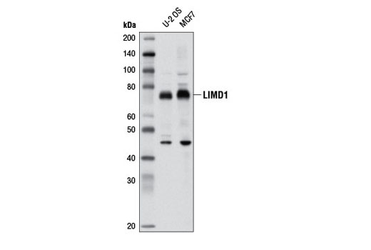 Western Blotting Image 1: LIMD1 Antibody