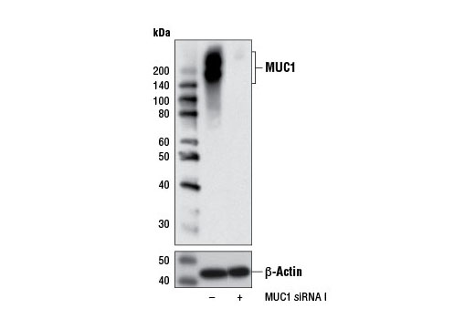  Image 1: SignalSilence® MUC1 siRNA I