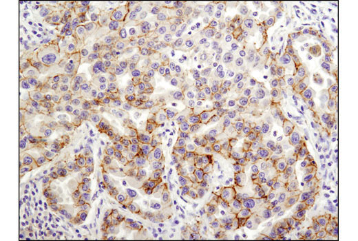 Immunohistochemistry Image 2: Claudin-1 (D5H1D) XP® Rabbit mAb