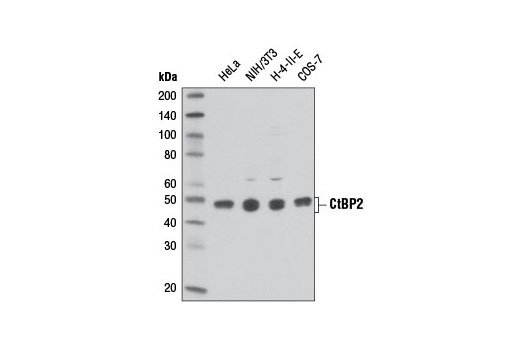 Western Blotting Image 1: CtBP2 Antibody