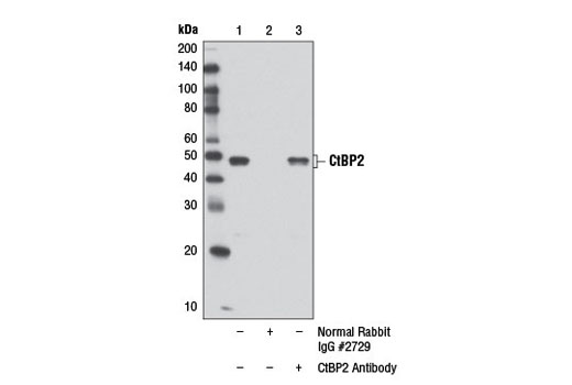 Immunoprecipitation Image 1: CtBP2 Antibody