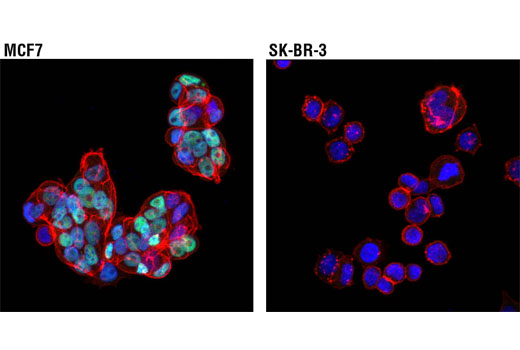 Immunofluorescence Image 1: Estrogen Receptor α (D6R2W) Rabbit mAb