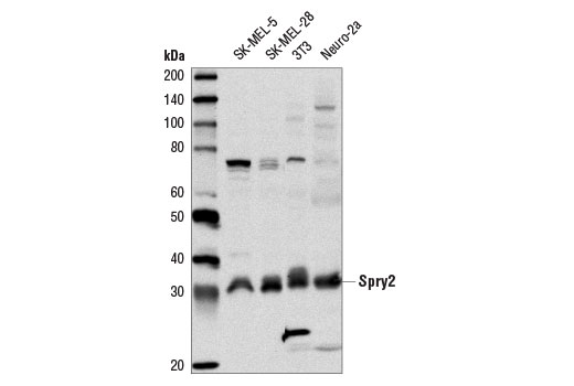 Western Blotting Image 1: Spry2 Antibody