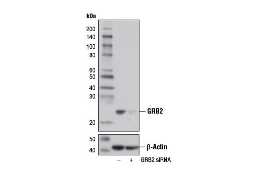  Image 1: SignalSilence® GRB2 siRNA I