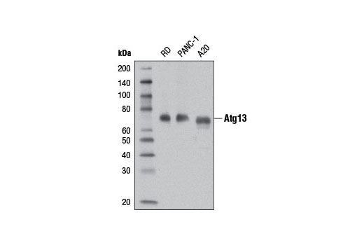  Image 4: Autophagy Induction (ULK1 Complex) Antibody Sampler Kit