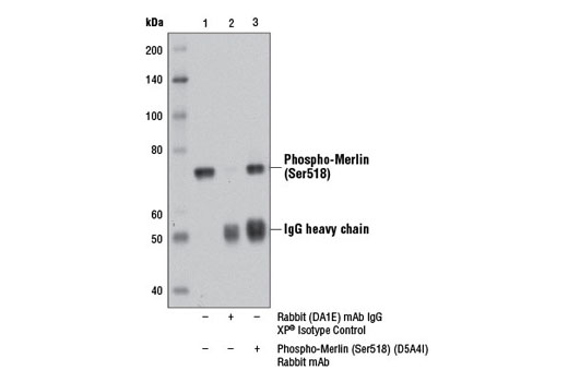 Immunoprecipitation Image 1: Phospho-Merlin (Ser518) (D5A4I) Rabbit mAb