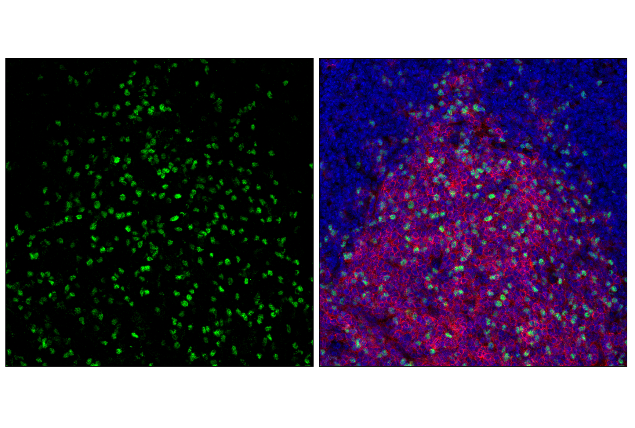 Immunofluorescence Image 1: FoxP3 (D6O8R) Rabbit mAb (Alexa Fluor® 488 Conjugate)