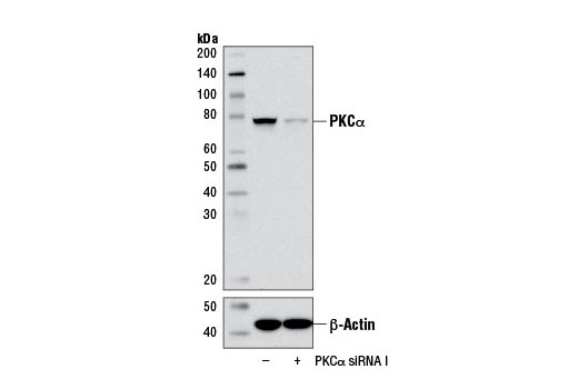  Image 1: SignalSilence® PKCα siRNA I