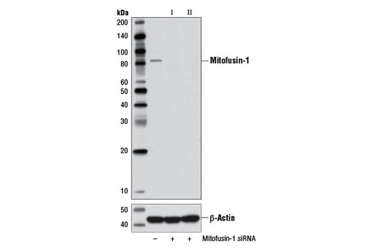  Image 1: SignalSilence® Mitofusin-1 siRNA II