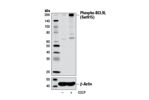 Western Blotting Image 2: Phospho-BCL9L (Ser915) Antibody