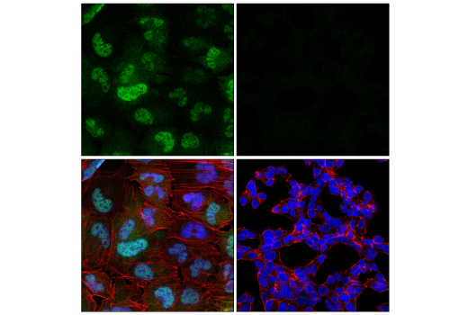 Immunofluorescence Image 1: CDK6 (D4S8S) Rabbit mAb